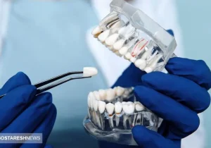 تعرفه‌های ۱۴۰۴ خدمات دندان پزشکی اعلام شد | کامپوزیت هر فک چند ؟