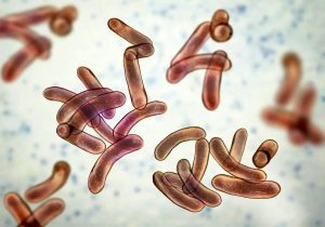 هشدار یک مقام مسئول در وزارت بهداشت درمورد شیوع وبا در فصل گرما