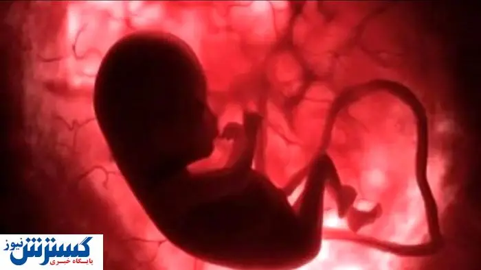 دولت شرایط سقط جنین قانونی را اعلام کرد | کدام روش بهتر است د؟