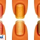 تشخیص سرطان ریه از روی ناخن ممکن شد
